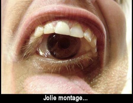 Oiel pour dent 